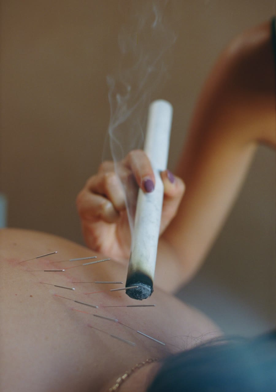Moxa warming acupuncture points on the back
