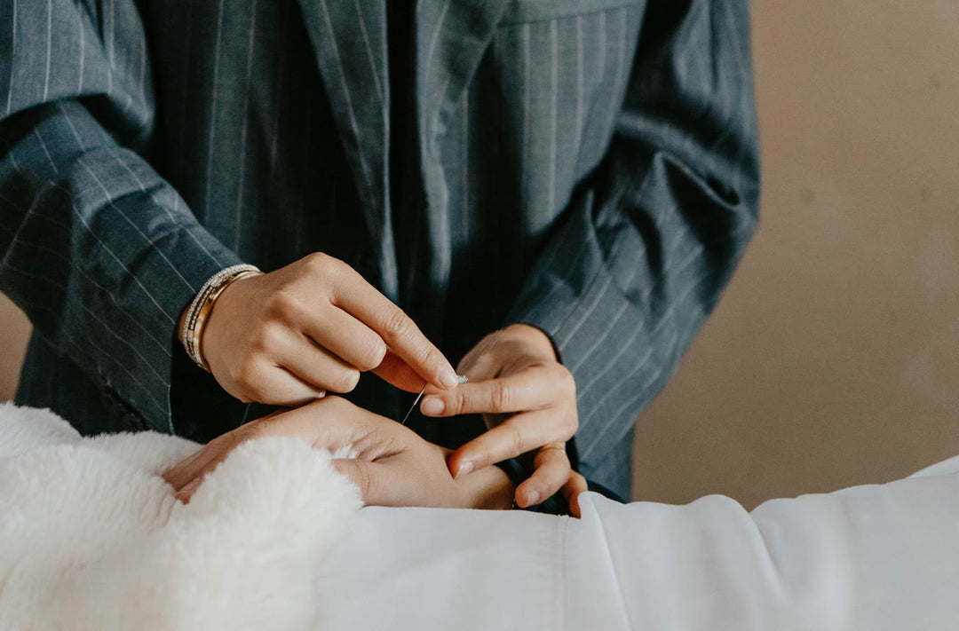 A practitioner placing acupuncture needles in the hand