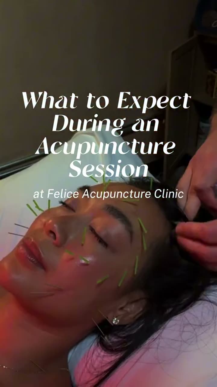 A real acupuncture session, step by step