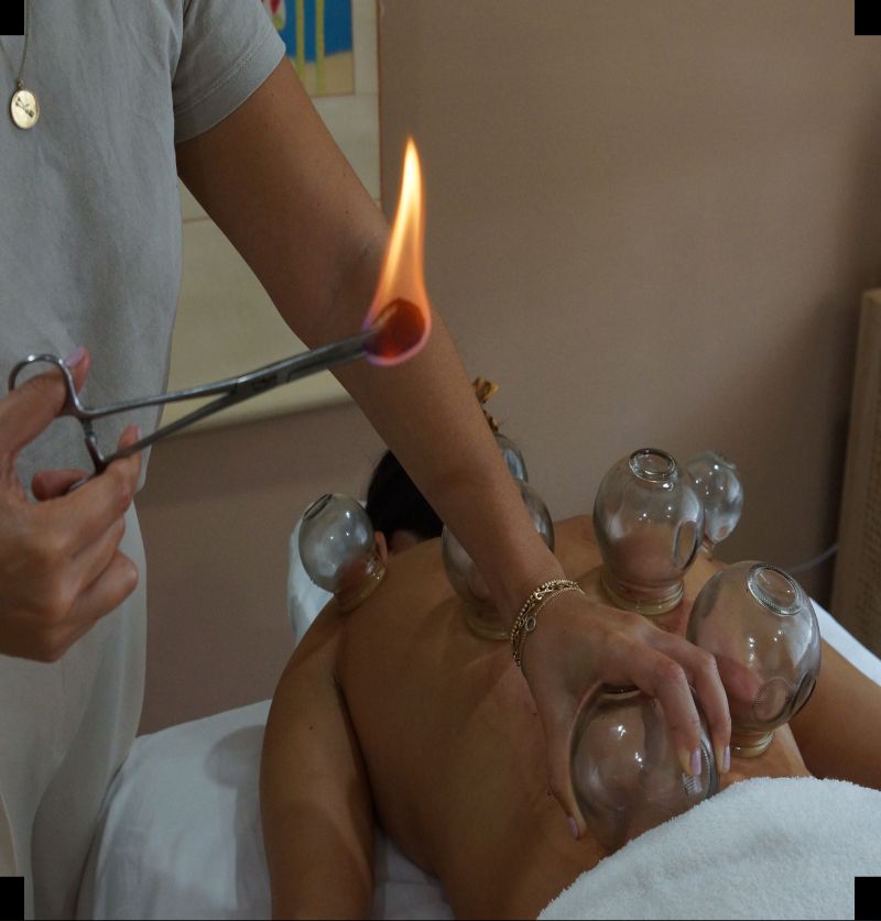 Cupping
